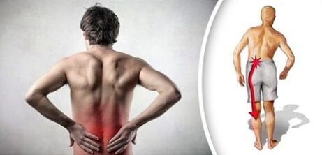 Aṣoju irora pẹlu awọn itankale osteoclondrosis Lootes si awọn ese