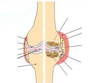 mu turpentine ati awọn iwẹ Pine